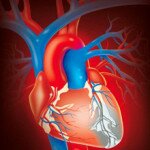Симптомы инфаркта-миокарда сердца